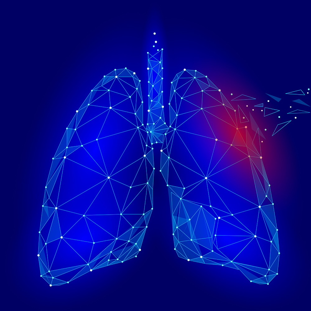 Human Internal Organ Lungs Medicine Treatment Drug. Low Poly technology design. Red injury pain area polygonal triangle connected dots. Health medicine